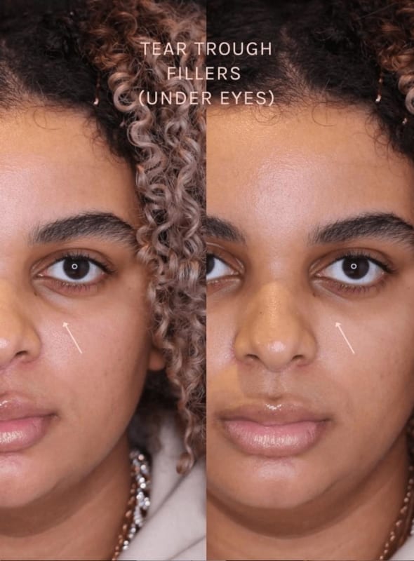 Cheat sleep: the best treatments for looking more awake