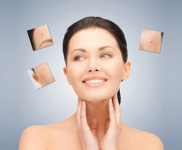 dermal fillers harley street