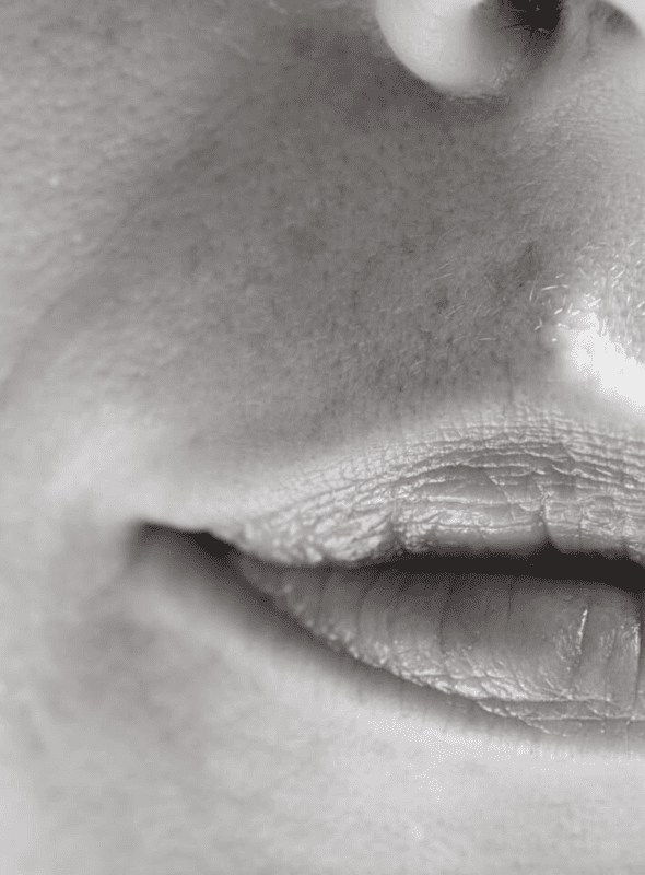 nasolabial folds